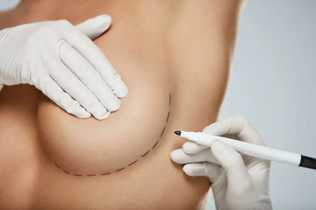 Chirurgie des Seins